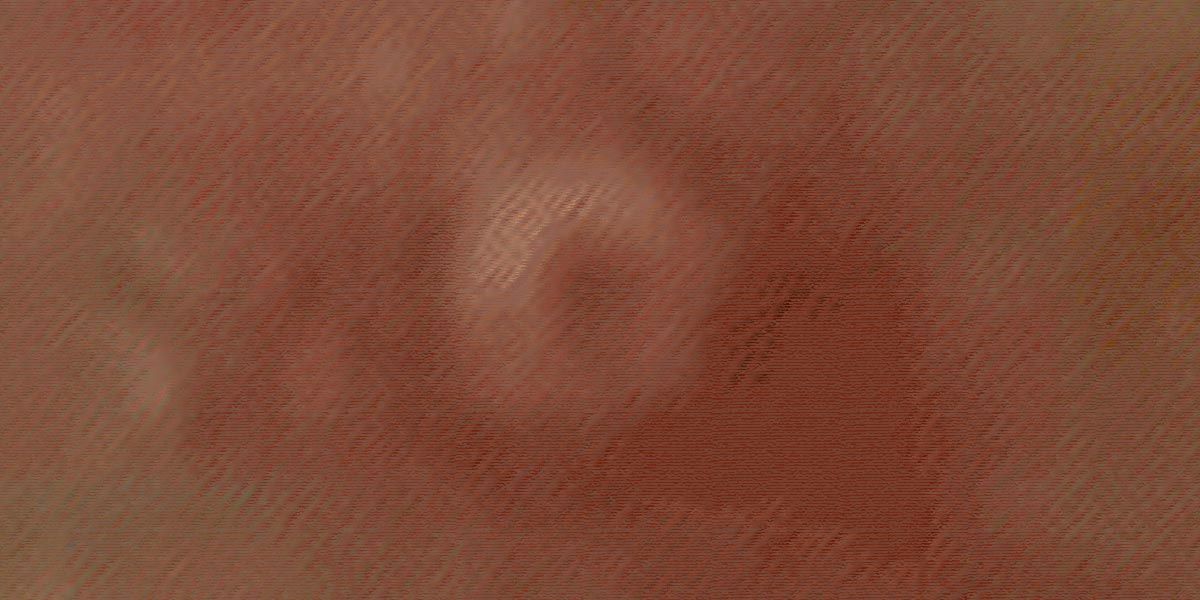 Aquela da Monkeypox…